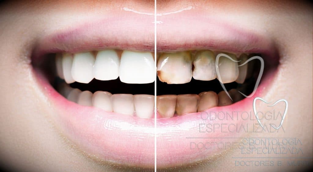 Breve historia de la odontología - Clínica Dental en Torremolinos Dentista  Torremolinos